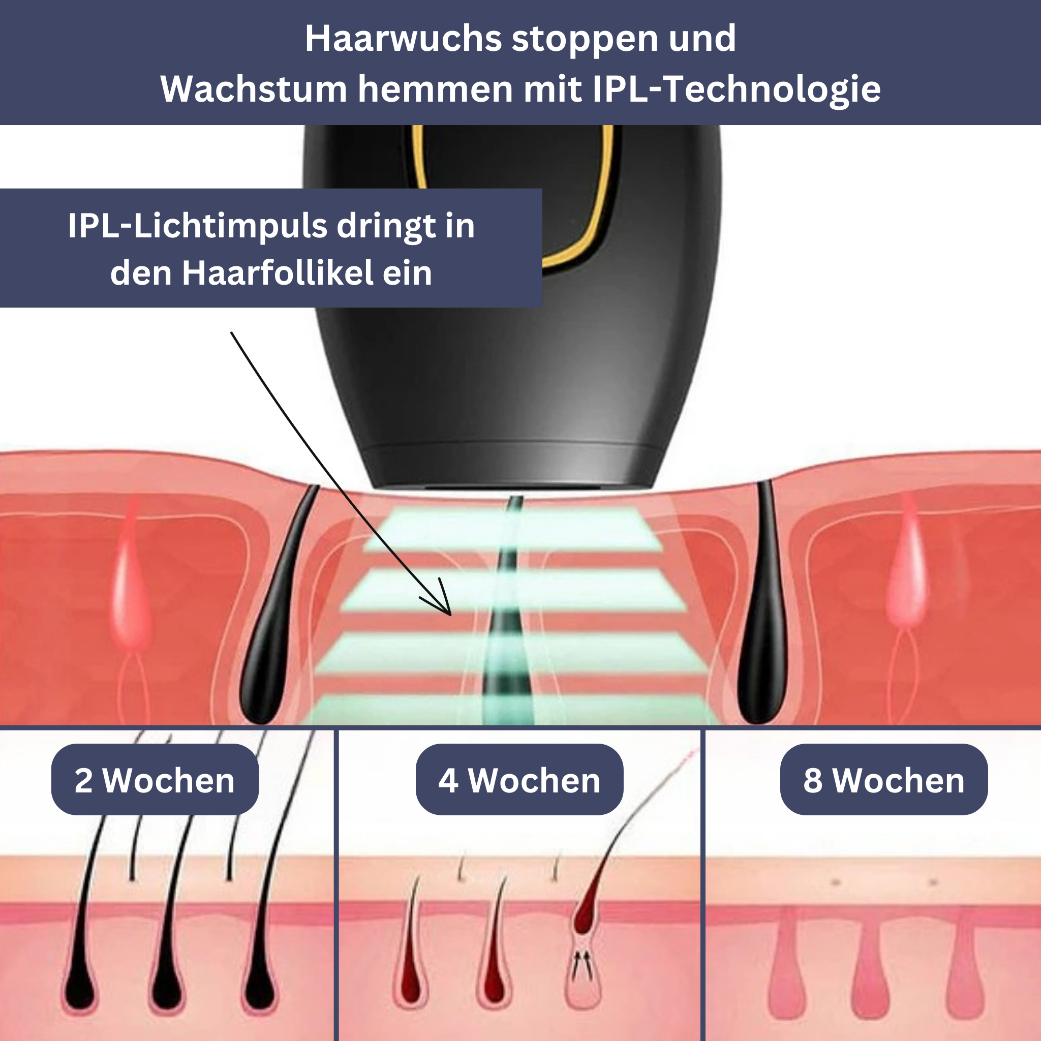 SmoothTouch IPL Epilierer