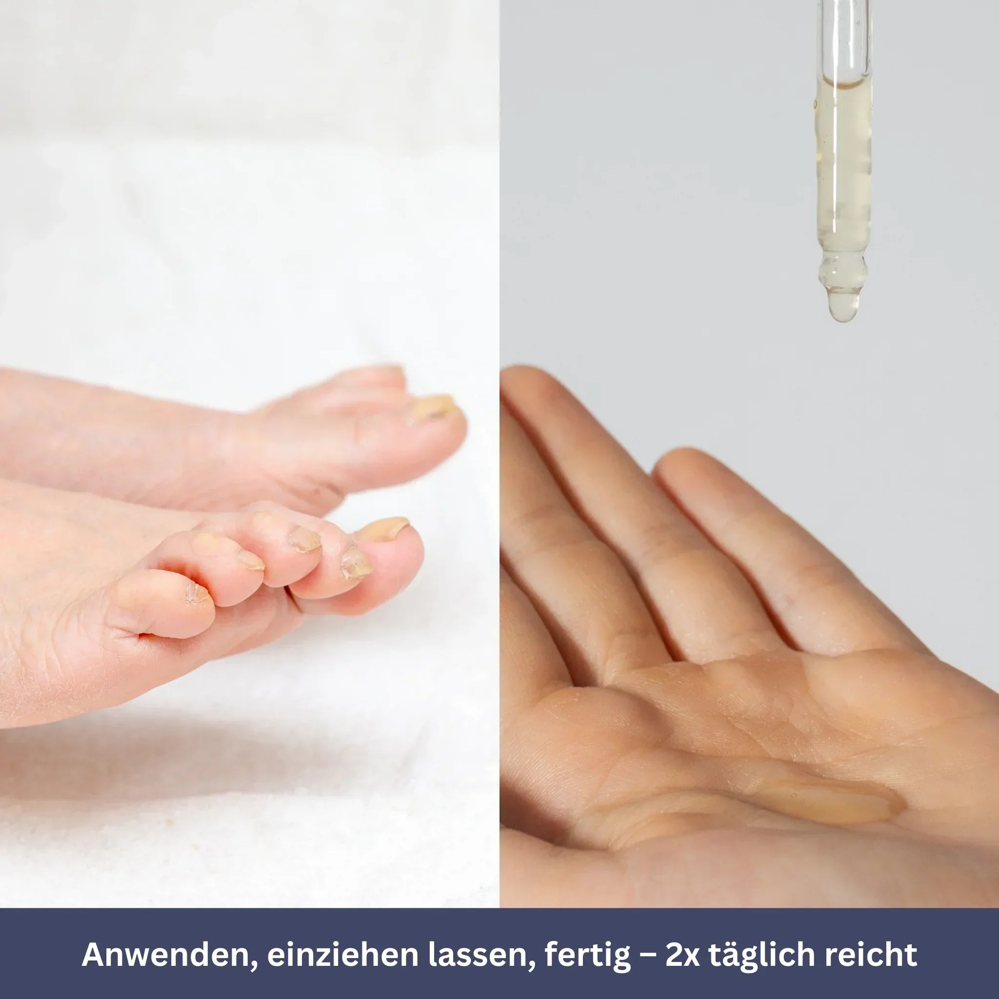 NailDrops - Pflegeserum gegen Nagelpilz