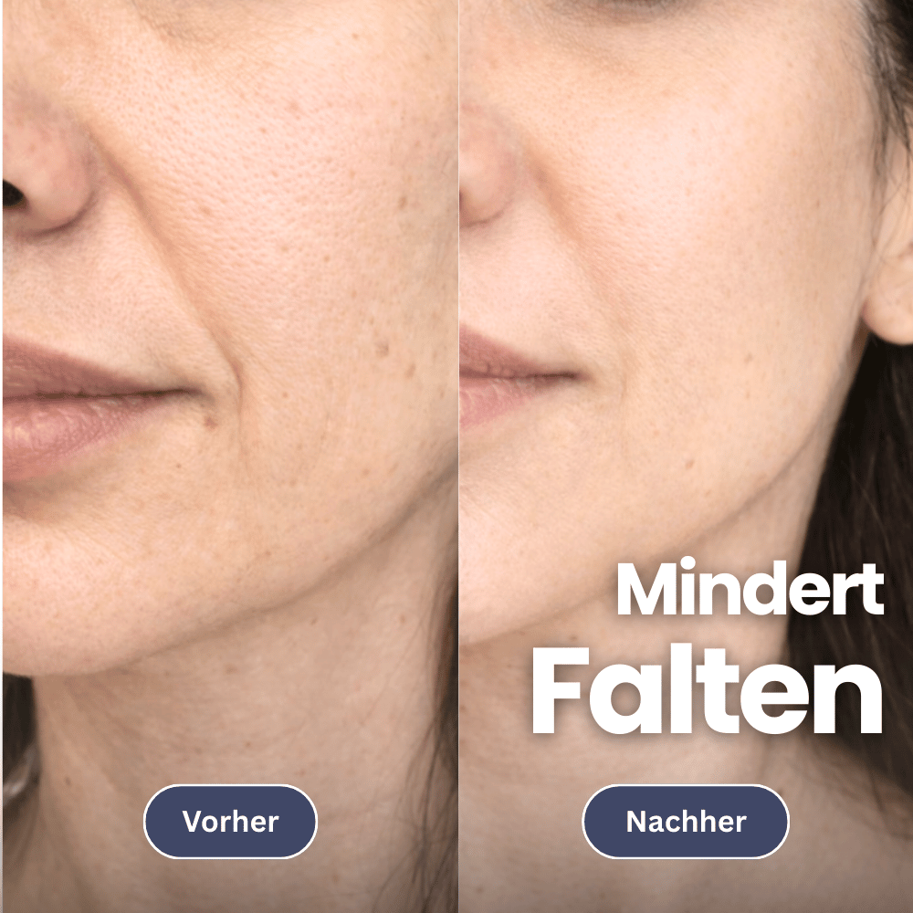 Microneedling Infusionset für eine straffe Haut