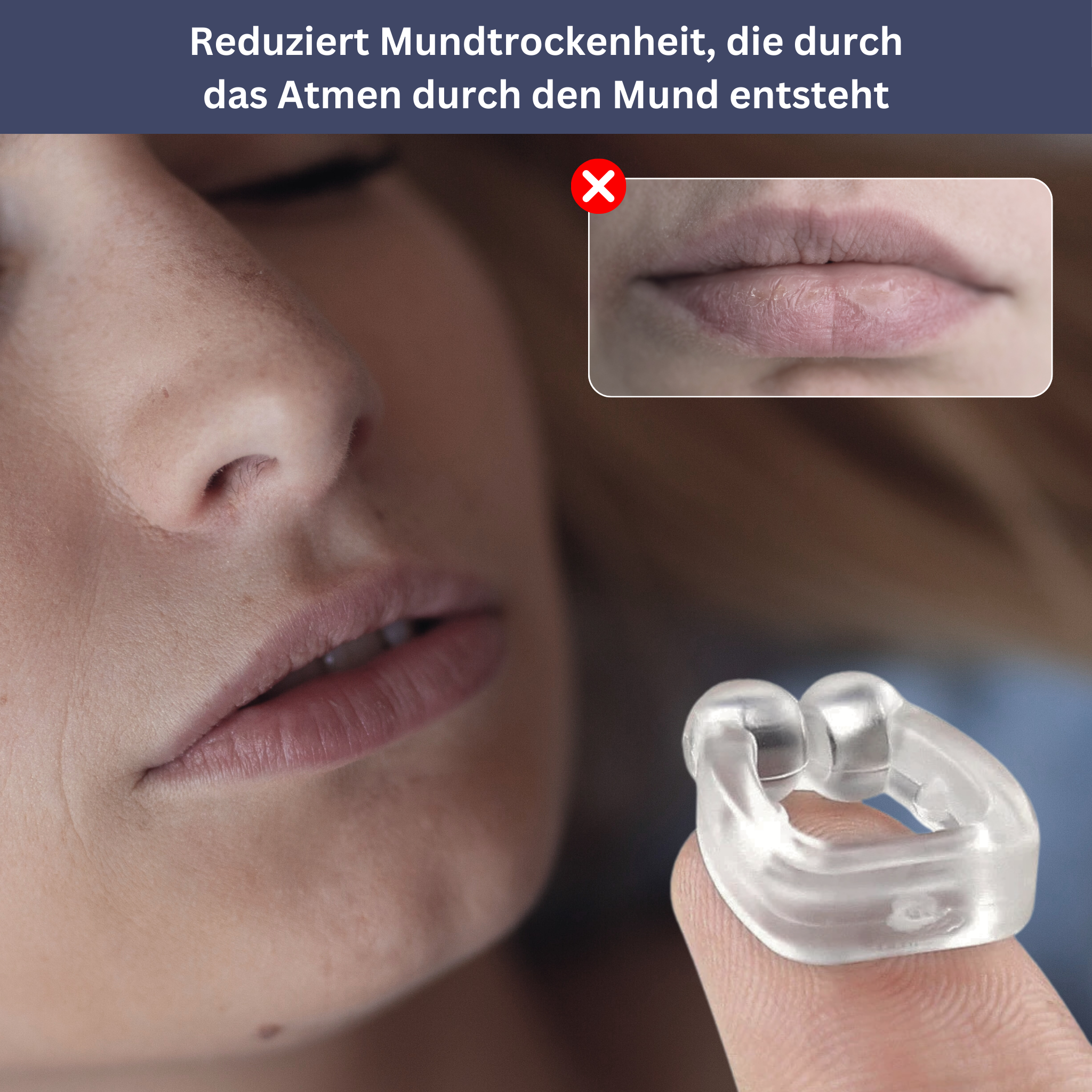 SilentBreeze - Magnetischer Schnarchstopper