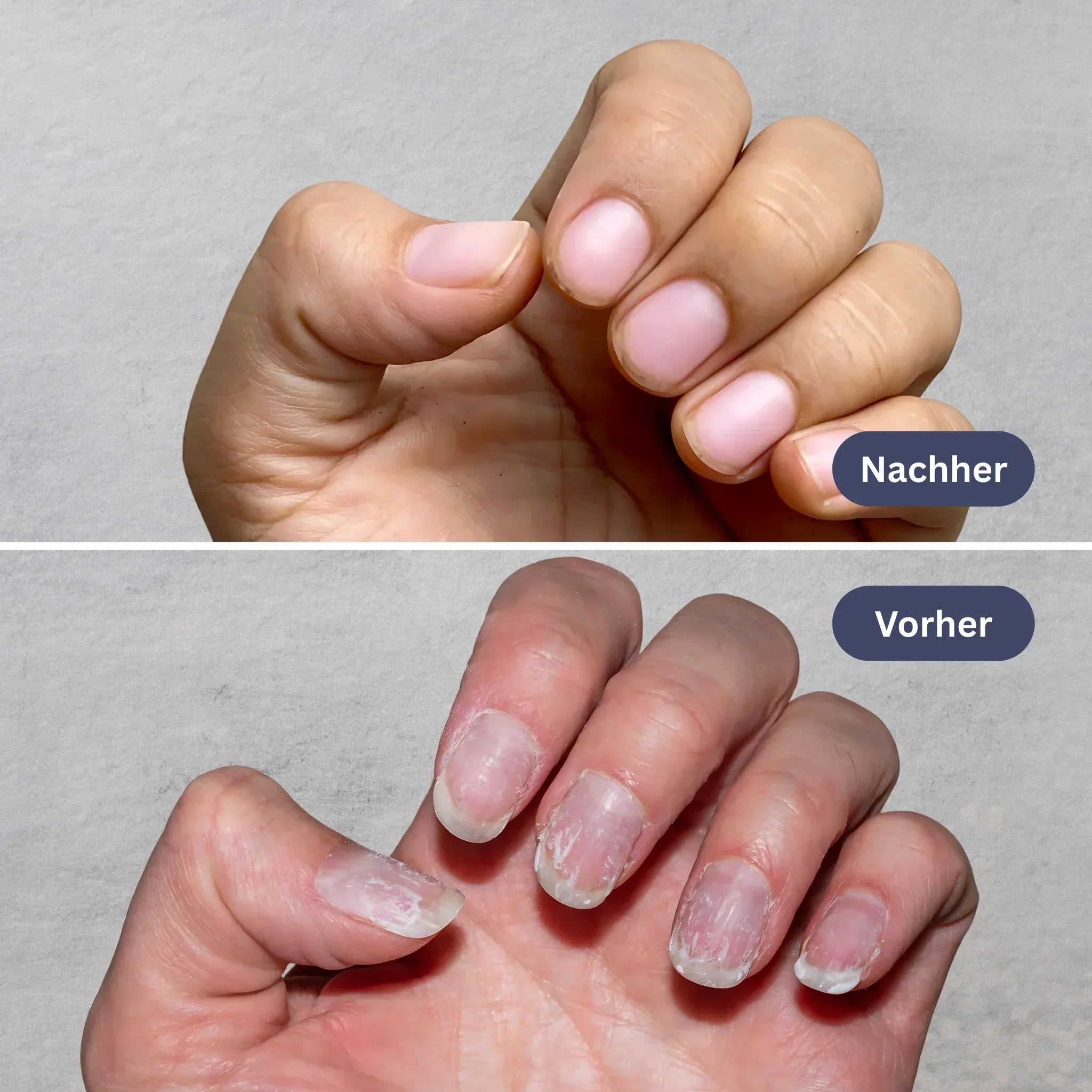 YILEST Natural Nail Care Pen