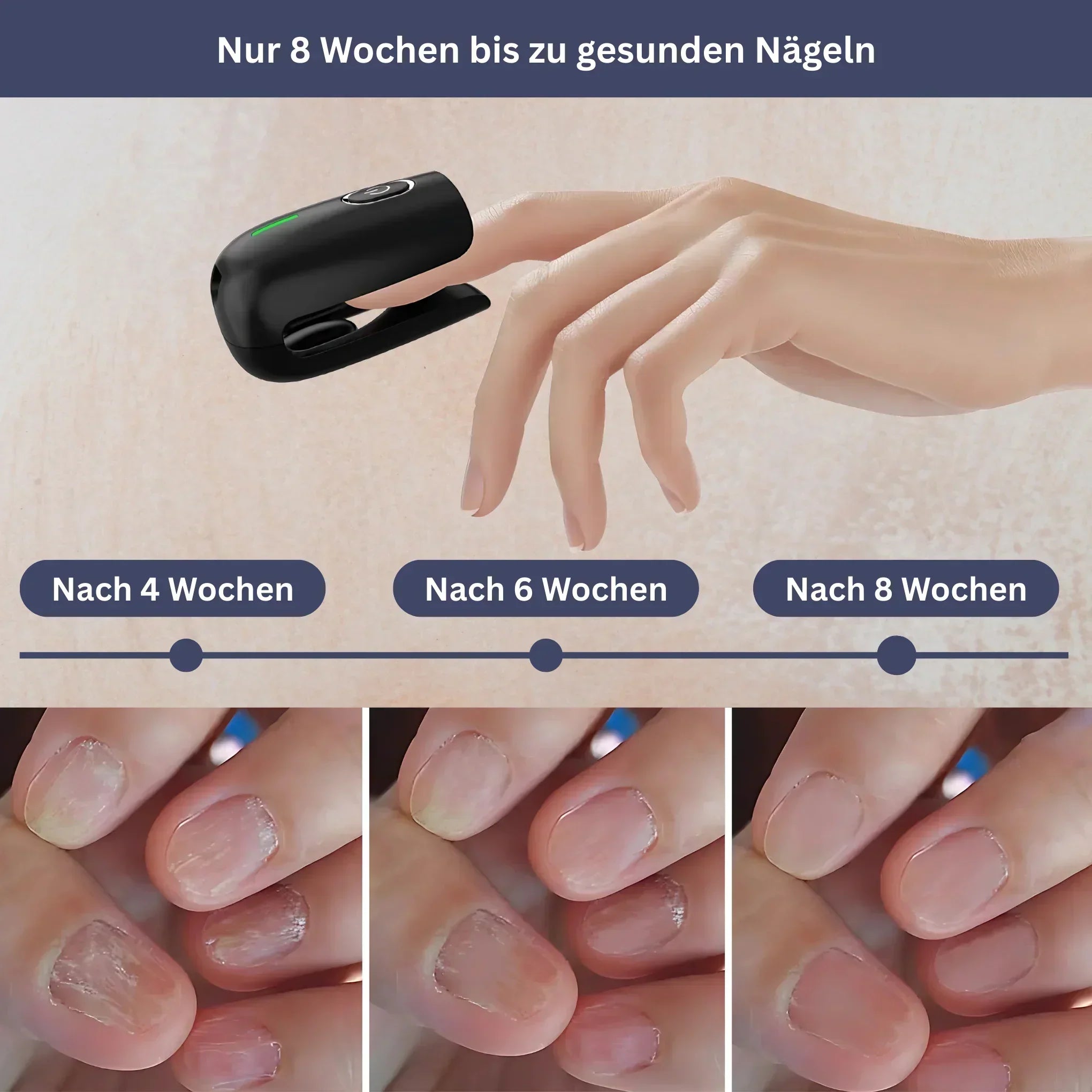 DermaClear Pro - Nail Care Device for Fungus Reduction & Cleaning