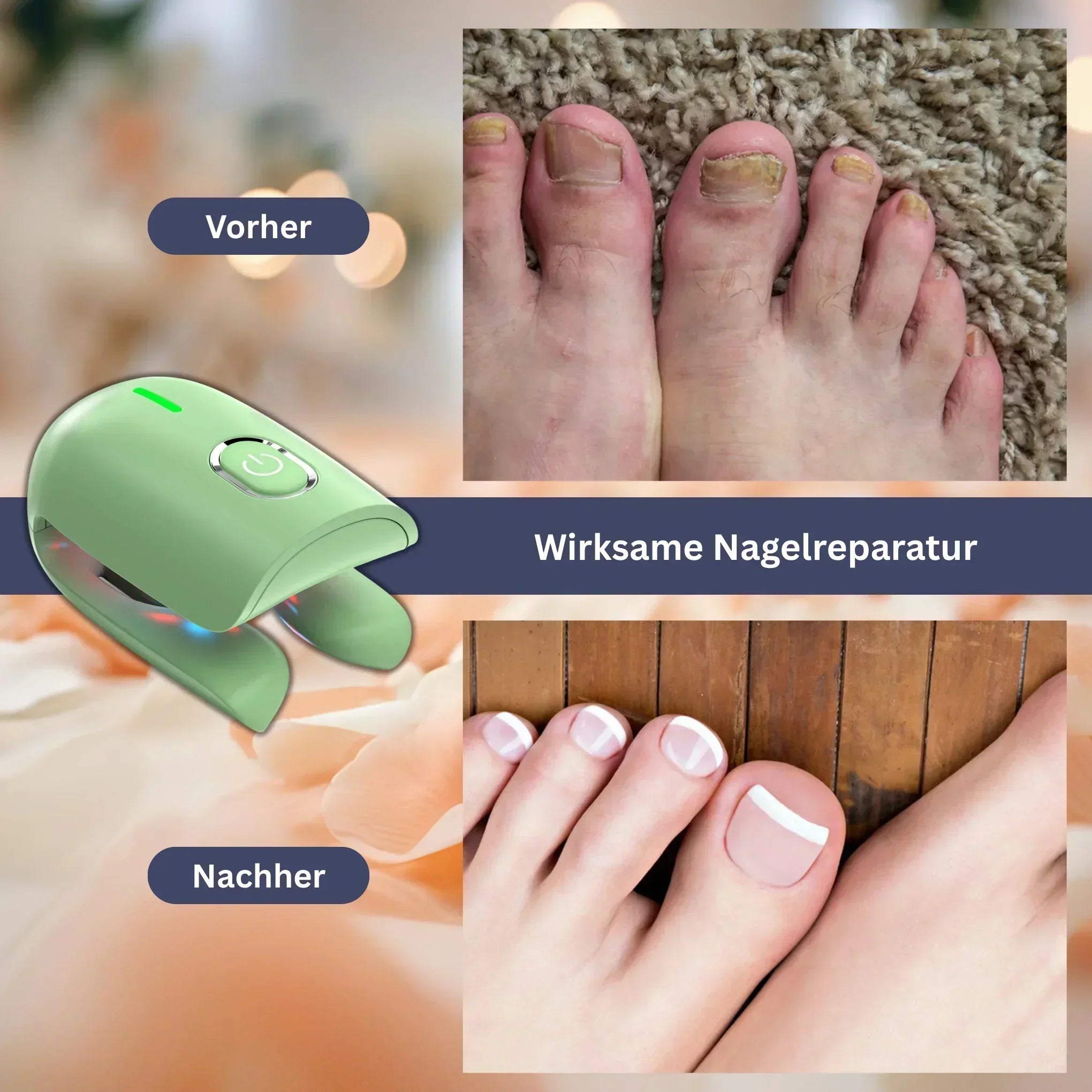 DermaClear Pro - Nail Care Device for Fungus Reduction & Cleaning